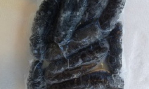 脑部延髓是什么意思专区_脑延髓在什么部位专区_延脑肿瘤的症状网